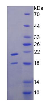 Recombinant Transient Receptor Potential Cation Channel Subfamily V, Member 6 (TRPV6)