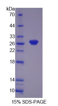 Recombinant Ribonucleotide Reductase M1 (RRM1)