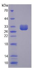 Recombinant Spectrin Beta, Non Erythrocytic 4 (SPTbN4)