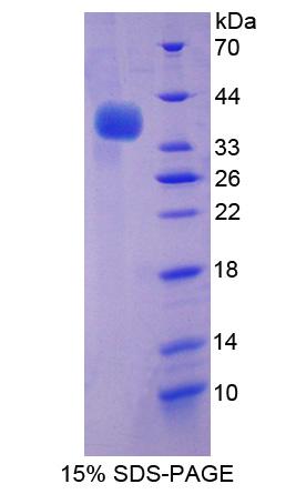 Recombinant Adaptor Related Protein Complex 2 Mu 1 (AP2m1)