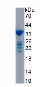 Recombinant Microtubule Associated Protein RP/EB Family, Member 1 (MAPRE1)