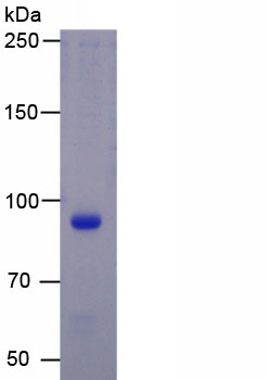 Recombinant Yes Associated Protein 1 (YAP1)