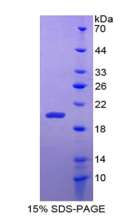 Recombinant Hepatocyte Nuclear Factor 1 Beta (HNF1b)