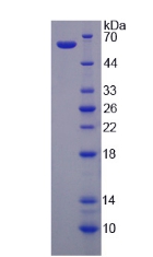 Recombinant Voltage Dependent Anion Channel Protein 1 (VDAC1)