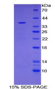 Recombinant Ubiquitin Carboxyl Terminal Hydrolase L5 (UCHL5)