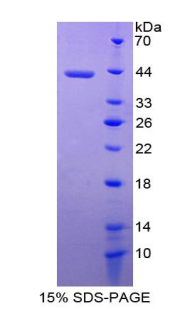 Recombinant Melanoma Inhibitory Activity Protein 1 (MIA1)