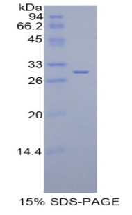 Recombinant Isocitrate Dehydrogenase 1, Soluble (IDH1)