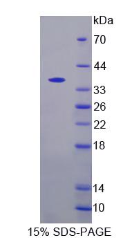 Recombinant Chitinase 3 Like Protein 2 (CHI3L2)