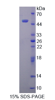 Recombinant Translocator Protein (TSPO)