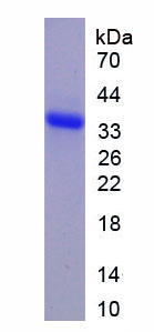Recombinant Wolfram Syndrome Protein 1 (WFS1)