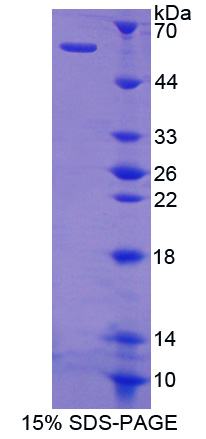 Recombinant Cat Eye Syndrome Chromosome Region, Candidate 1 (CECR1)