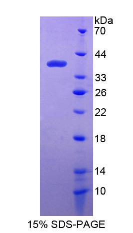Recombinant Interferon Inducible Protein 35 (IFI35)