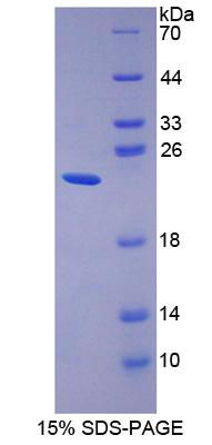 Recombinant Ubiquitin Cross Reactive Protein (UCRP)