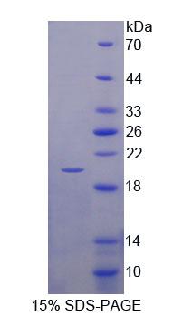 Recombinant Microtubule Associated Protein 1 Light Chain 3 Alpha (MAP1LC3a)