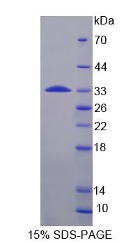 Recombinant Ribosomal Protein S6 Kinase Beta 1 (RPS6Kb1)