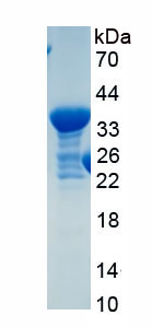 Recombinant Steroid 5 Alpha Reductase 2 (SRD5a2)