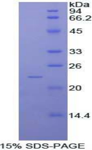 Recombinant Non Metastatic Cells 6, Protein Expressed In (NME6)