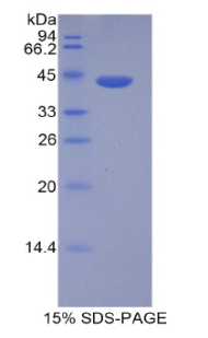 Recombinant Histone Cluster 1, H2ad (HIST1H2AD)