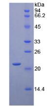 Recombinant Cluster Of Differentiation 8b (CD8b)