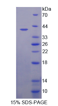 Recombinant Aldose Reductase Like Protein 1 (ARL1)