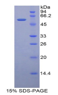 Recombinant CUB And Zona Pellucida Like Domains Protein 1 (CUZD1)