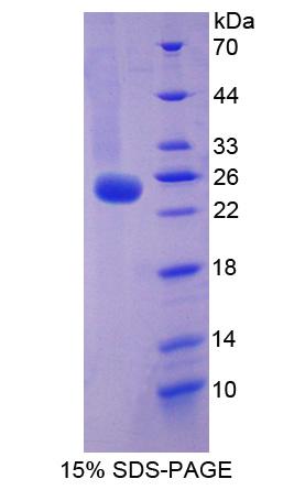 Recombinant Family With Sequence Similarity 5, Member C (FAM5C)