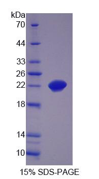 Recombinant SCAN Domain Containing Protein 3 (SCAND3)