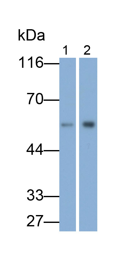 HRP-Linked Rabbit Anti-Human IgG Polyclonal Antibody