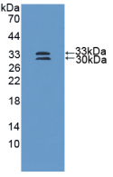 Active Superoxide Dismutase 3, Extracellular (SOD3)