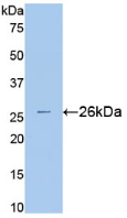 Active Superoxide Dismutase 3, Extracellular (SOD3)
