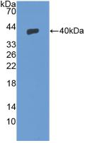 Active Stromal Cell Derived Factor 1 (SDF1)