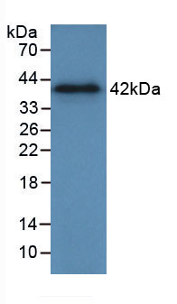 Active Annexin A2 (ANXA2)