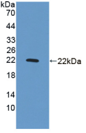 Active Growth Arrest And DNA Damage Inducible Protein Alpha (GADD45a)