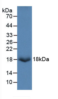 Active Fibronectin Type III Domain Containing Protein 5 (FNDC5)