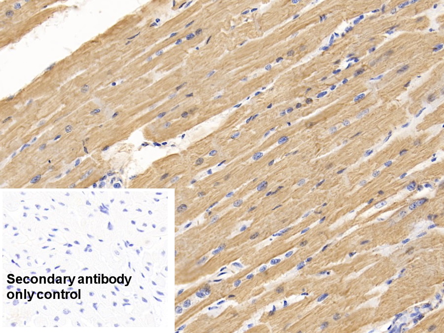 Anti-Actin Alpha 1, Cardiac Muscle (ACTC1) Monoclonal Antibody