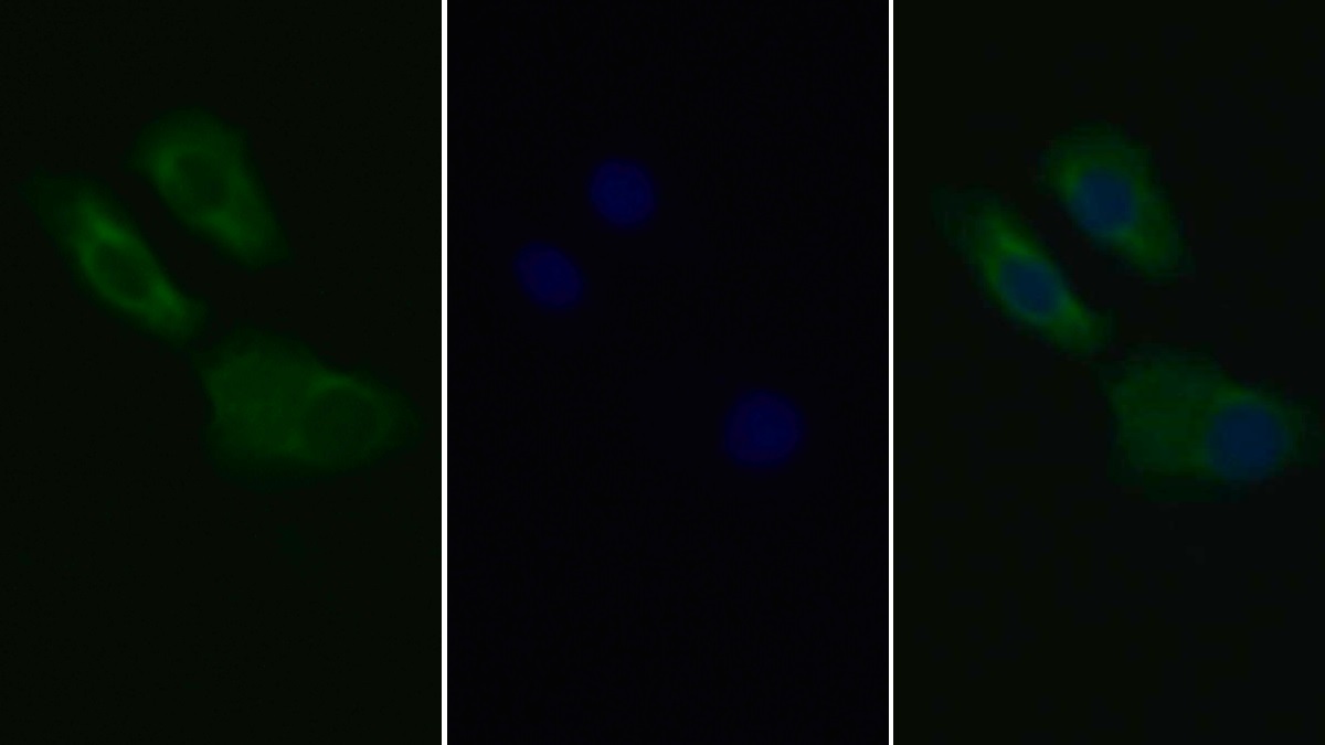 Anti-Platelet Derived Growth Factor Receptor Alpha (PDGFRa) Monoclonal Antibody