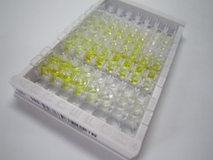 ELISA Kit for Serum Amyloid A (SAA)