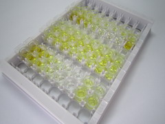 ELISA Kit for Acetylcarnitine (ALCAR)
