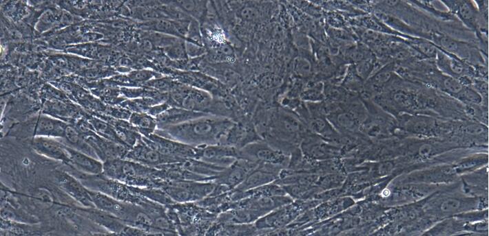 Primary Caprine Bladder Stromal Fibroblasts (BSF)