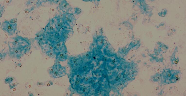 Primary Rabbit Bone Marrow-derived Mesenchymal Stem Cells (BMMSCs)