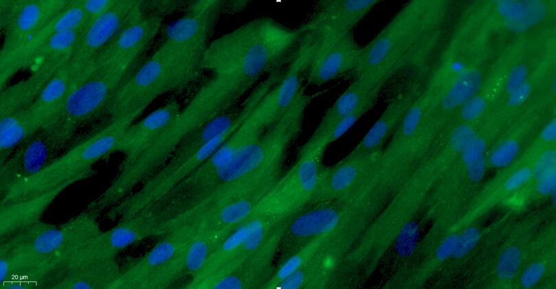 Primary Caprine Aortic Smooth Muscle Cells (ASMC)