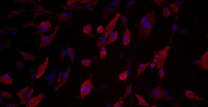 Primary Mouse Bladder Epithelial Cells (BEC)