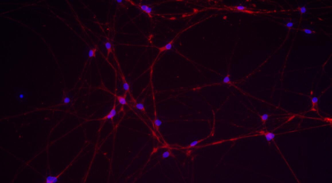 Primary Rat Trigeminal ganglion neuron cells (TGN)