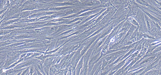 Primary Rabbit Ureteral Smooth Muscle Cells (USMC)