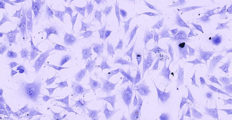 Primary Rabbit Meniscus Fibrochondrocytes (MFCs)