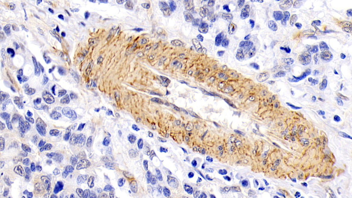 Biotin-Linked Monoclonal Antibody to Platelet Derived Growth Factor AA (PDGFAA)