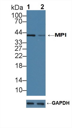 Biotin-Linked Polyclonal Antibody to Promyelocytic Leukemia Protein (PML)