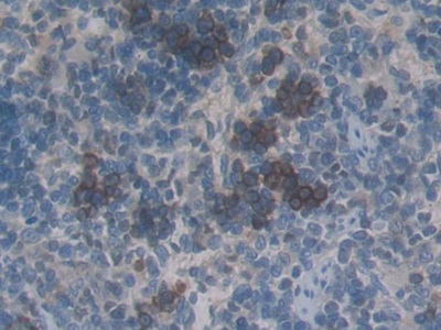 Monoclonal Antibody to Connective Tissue Growth Factor (CTGF)