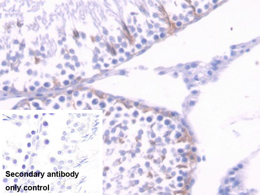 Monoclonal Antibody to Interferon Alpha (IFNa)