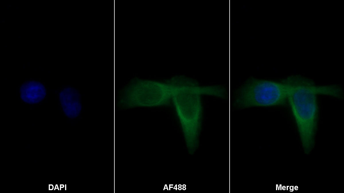 Monoclonal Antibody to Insulin Like Growth Factor Binding Protein 3 (IGFBP3)
